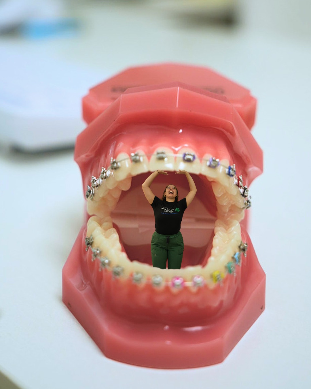 Tiny team — inside the braces model