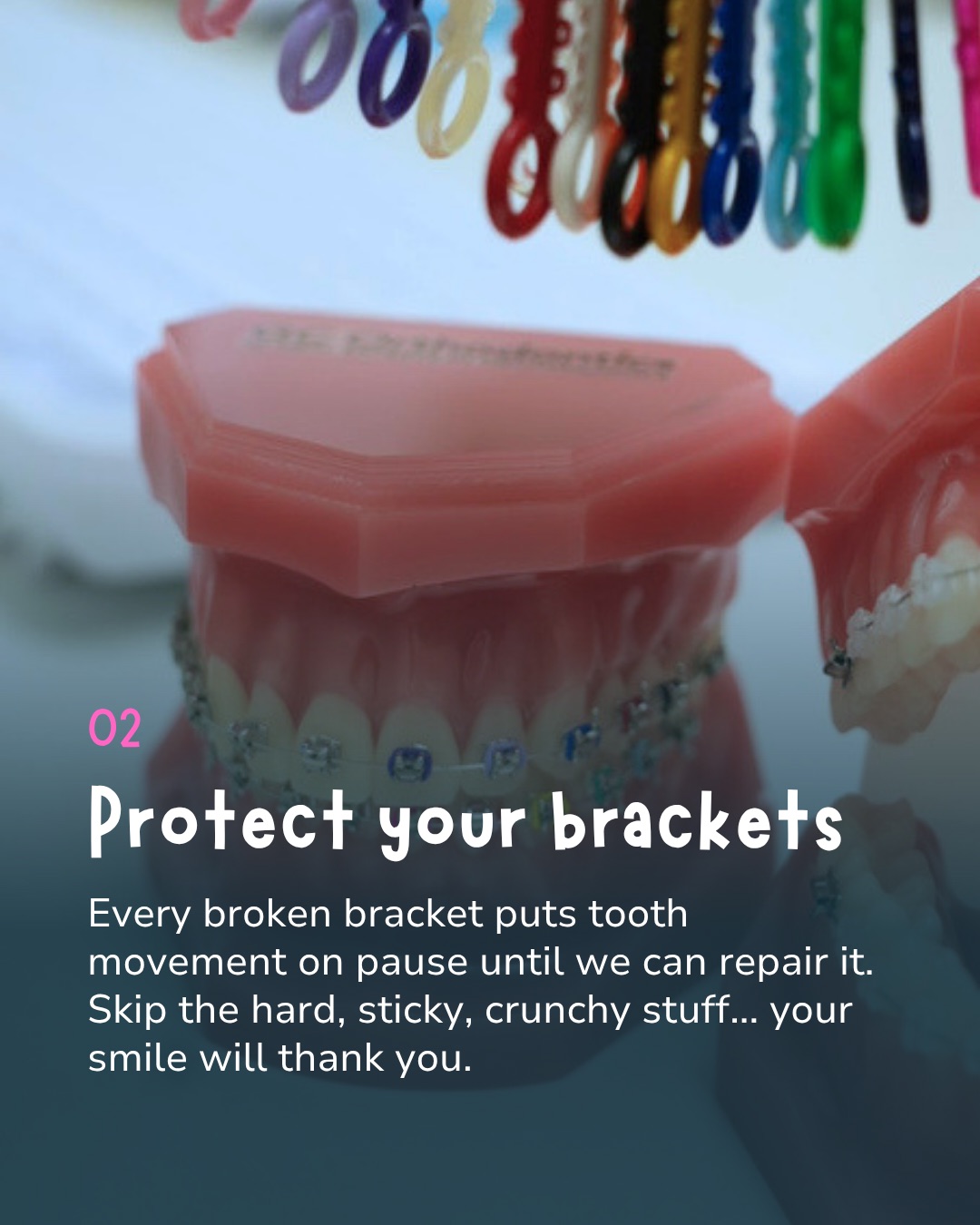 Tip 02